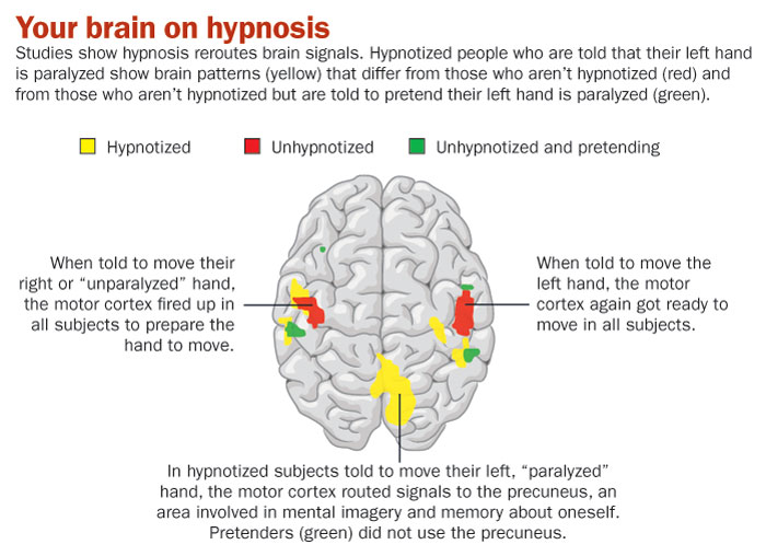 催眠你的大脑如何改善健康