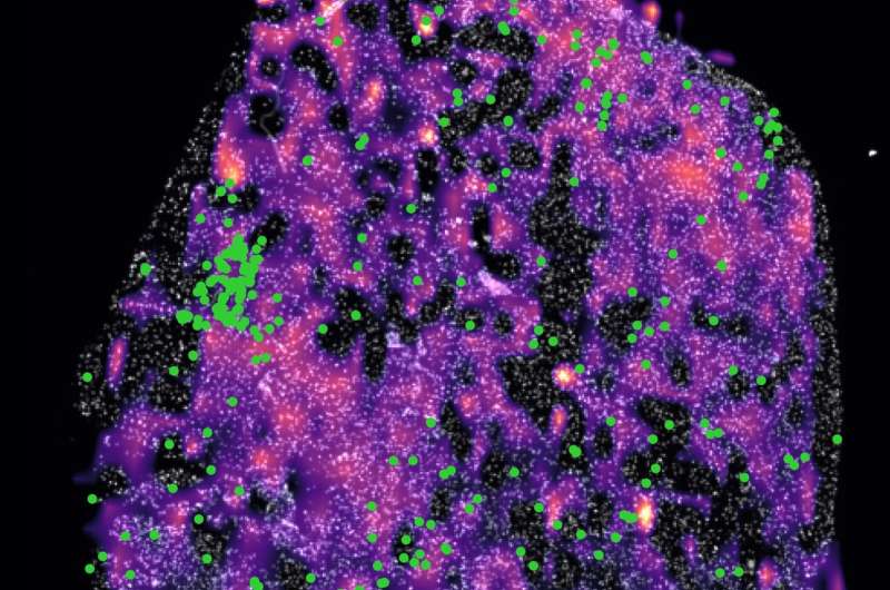 研究表明，某些癌症如何中和T细胞以破坏免疫系统并帮助肿瘤生长